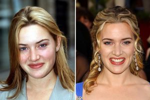 Then and Now Celebrity Photos That Will Amaze You - - Metiorr